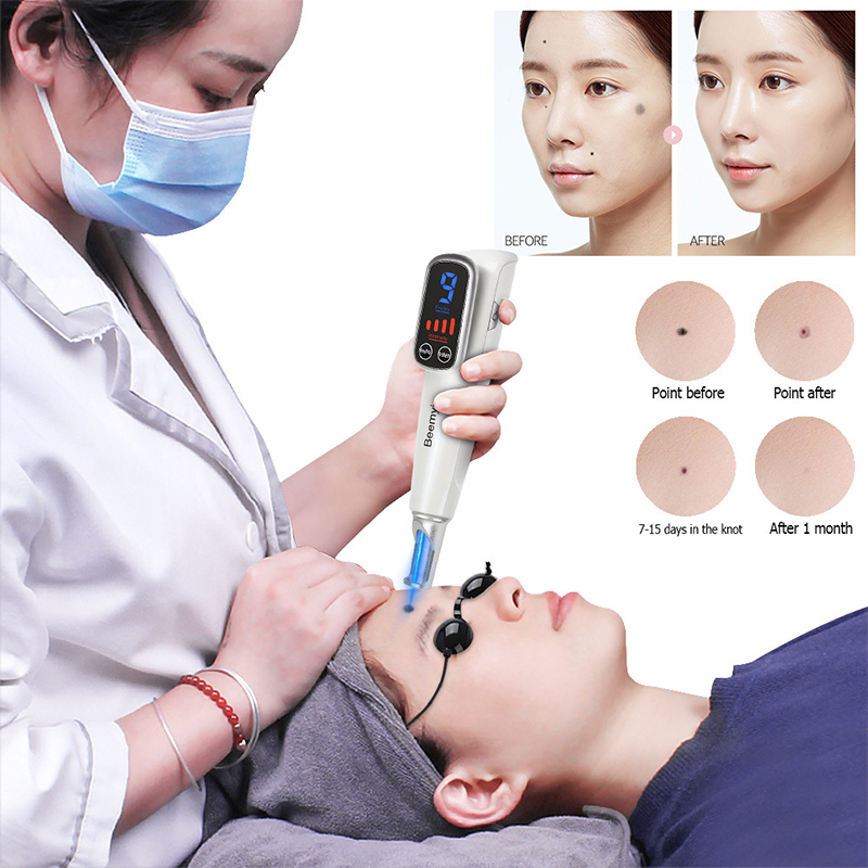 # Profesjonalny długopis laser – Picosecond Laser Freckle Mole Remover recenzja i cena