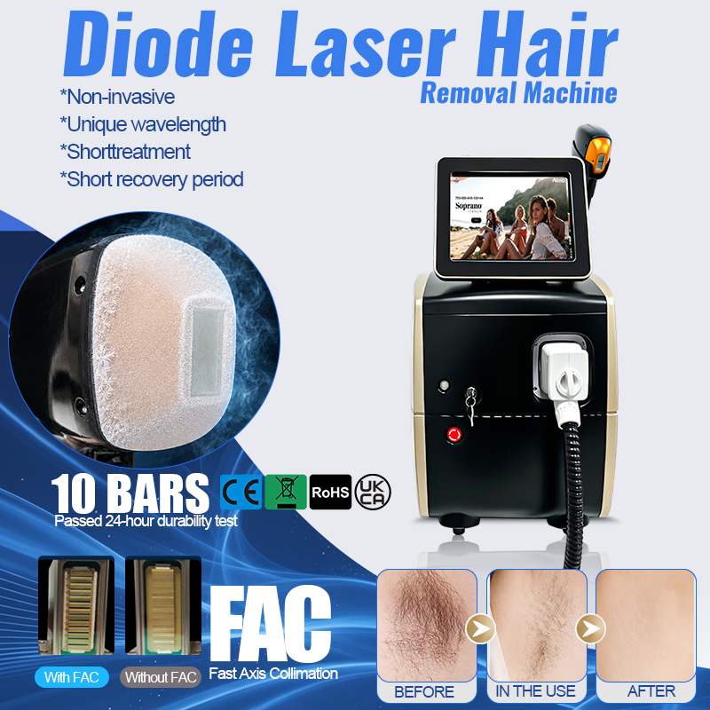 Ulepszony w 2025 roku laser do – Laser Hair Removal Diode 808 recenzja i cena