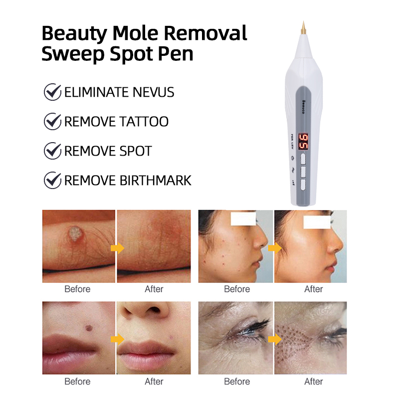 Długopis do usuwania znamion i – Plasma Mole Spot Removal Pen 9 Level recenzja i cena