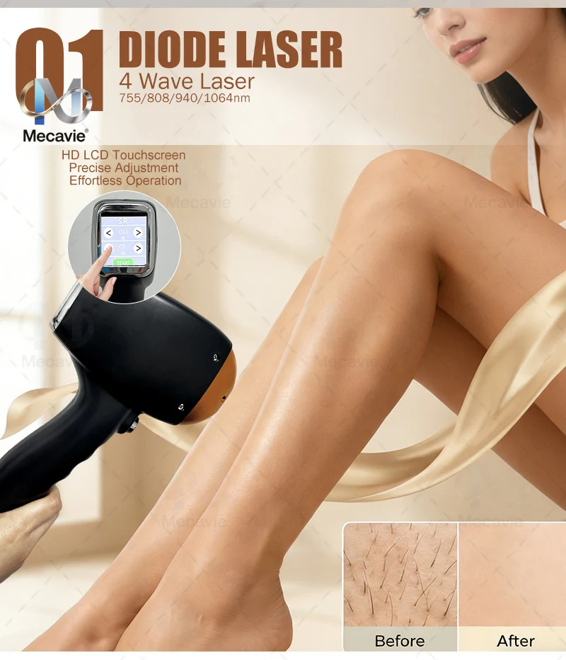4 w 1 Najnowszy model z 2026 r – Laser Hair Removal Diode 808 recenzja i cena