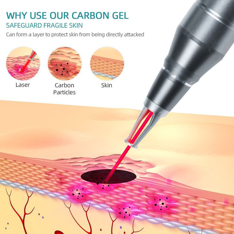10 SZTUK 5 SZTUK 2 SZTUKI 1 SZ – Laser Carbon Peel Cream Gel 80Ml recenzja i cena
